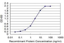 Anti-MED21 Mouse Monoclonal Antibody [clone: 6B6]