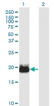 Anti-IFT20 Mouse Monoclonal Antibody [clone: 3F3]