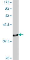 Anti-MED26 Mouse Polyclonal Antibody