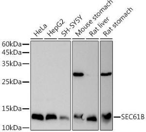 Western blot analysis of extracts of various cell lines, using Anti-SEC61B Antibody (A307609) at 1:1,000 dilution