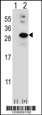 Anti-GLO1 Rabbit Polyclonal Antibody