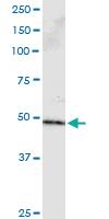 Anti-PPP2R2B Antibody Pair