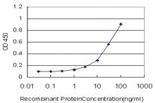 Anti-HMBS Mouse Monoclonal Antibody [clone: 3E8]