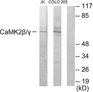 Western blot analysis of lysates from COLO205 and Jurkat cells using Anti-CaMK2 beta + gamma Antibody. The right hand lane represents a negative control, where the Antibody is blocked by the immunising peptide