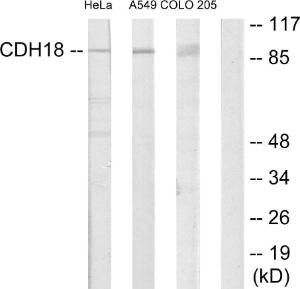 Western blot analysis of lysates from HeLa, A549, and COLO205 cells using Anti-CDH18 Antibody. The right hand lane represents a negative control, where the antibody is blocked by the immunising peptide.