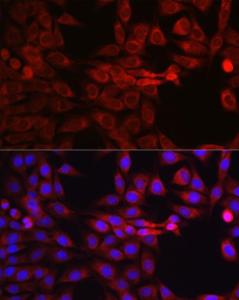 Immunofluorescence analysis of NIH/3T3 cells using Anti-SEC61B Antibody (A307609) at a dilution of 1:100 (40X lens). DAPI was used to stain the cell nuclei (blue)