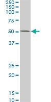 Anti-CSNK1G2 Mouse Monoclonal Antibody [clone: 2E6]