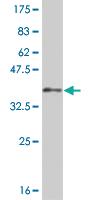 Anti-LHX5 Mouse Monoclonal Antibody [clone: 2B11]