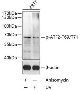 Western blot analysis of extracts of 293T cells, using Anti-ATF2 (phospho Thr69 + Thr71) Antibody (A11004) at 1:1,000 dilution