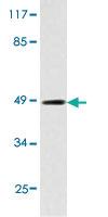 Anti-IKBKG Rabbit Polyclonal Antibody