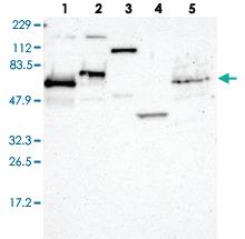 Anti-ETV3 Rabbit Polyclonal Antibody