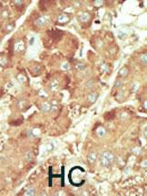 Anti-NLK Rabbit Polyclonal Antibody (Biotin)