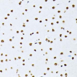 Immunohistochemistry analysis of paraffin-embedded rat brain using Anti-ATF2 (phospho Thr69 + Thr71) Antibody (A11004) at a dilution of 1:100 (40X lens)