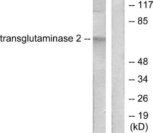 Anti-Transglutaminase 2 antibody