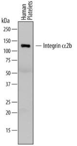 Anti-ITGA2B Mouse Monoclonal Antibody [clone: 745201]