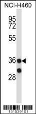 Anti-MARCH11 Rabbit Polyclonal Antibody (AP (Alkaline Phosphatase))