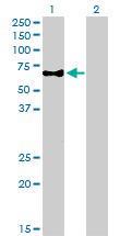 Anti-CAMKK1 Mouse Monoclonal Antibody [clone: 1F6]