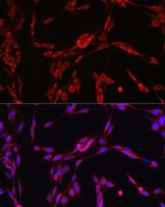 Immunofluorescence analysis of PC-12 cells using Anti-SEC61B Antibody (A307609) at a dilution of 1:100 (40X lens). DAPI was used to stain the cell nuclei (blue)