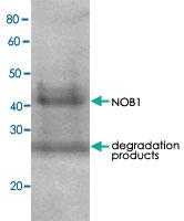 Anti-NOB1 Rabbit Polyclonal Antibody