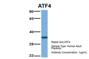 Anti-ATF4 Rabbit Polyclonal Antibody