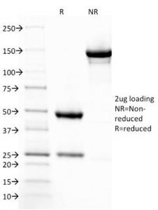 SDS-PAGE analysis of Anti-Thrombomodulin Antibody [THBD/1782] under non-reduced and reduced conditions; showing intact IgG and intact heavy and light chains, respectively. SDS-PAGE analysis confirms the integrity and purity of the antibody