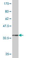 Anti-LHX5 Mouse Monoclonal Antibody [clone: 2C6]