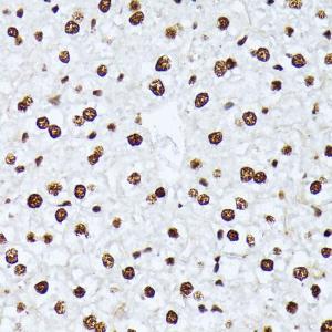 Immunohistochemistry analysis of paraffin-embedded mouse liver using Anti-ATF2 (phospho Thr69 + Thr71) Antibody (A11004) at a dilution of 1:100 (40X lens)