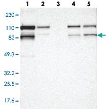 Anti-VEZT Rabbit Polyclonal Antibody