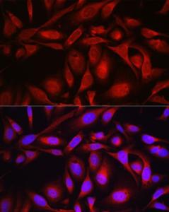 Immunofluorescence analysis of U2OS cells using Anti-SEC61B Antibody (A307609) at a dilution of 1:100 (40X lens). DAPI was used to stain the cell nuclei (blue)