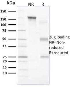 SDS-PAGE analysis of Anti-Vinculin Antibody [VCL/2573] under non-reduced and reduced conditions; showing intact IgG and intact heavy and light chains, respectively. SDS-PAGE analysis confirms the integrity and purity of the antibody.