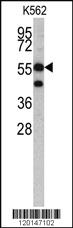 Anti-HMGCS1 Rabbit Polyclonal Antibody