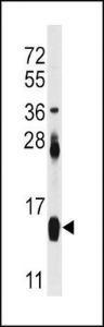 Anti-FABP4 Rabbit Polyclonal Antibody (AP (Alkaline Phosphatase))