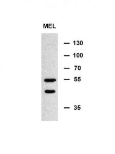 Anti-MINPP1 Rabbit Polyclonal Antibody (Biotin)