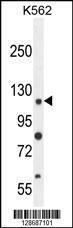 Anti-ANKRD52 Rabbit Polyclonal Antibody (HRP (Horseradish Peroxidase))