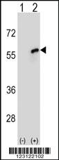 Anti-CDC20 Rabbit Polyclonal Antibody