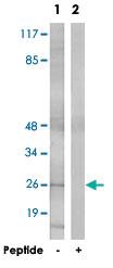 Anti-CLDN6 Rabbit Polyclonal Antibody