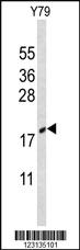 Anti-CIRBP Rabbit Polyclonal Antibody