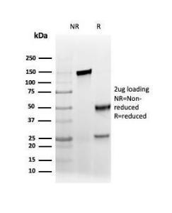 SDS-PAGE analysis of Anti-AMACR Antibody [rAMACR/6369] under non-reduced and reduced conditions; showing intact IgG and intact heavy and light chains, respectively. SDS-PAGE analysis confirms the integrity and purity of the antibody