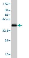 Anti-CSNK1G1 Mouse Monoclonal Antibody [clone: 2E10]