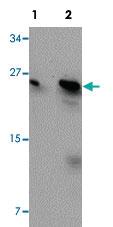 Anti-BCAS2 Rabbit Polyclonal Antibody