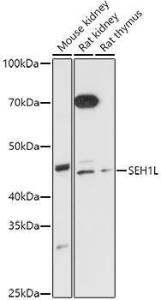 Western blot analysis of extracts of various cell lines, using Anti-SEH1L Antibody (A308658) at 1:1000 dilution. The secondary Antibody was Goat Anti-Rabbit IgG H&L Antibody (HRP) at 1:10000 dilution. Lysates/proteins were present at 25 µg per lane