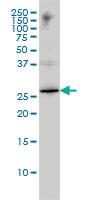 Anti-HMGB1 Mouse Monoclonal Antibody [clone: 1D5]