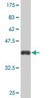 Anti-CEMIP Mouse Monoclonal Antibody [clone: 3C12]