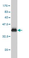 Anti-FARSA Mouse Monoclonal Antibody [clone: 2D8]