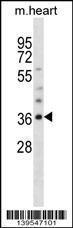 Anti-OLIG1 Rabbit Polyclonal Antibody (HRP (Horseradish Peroxidase))