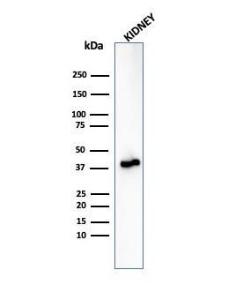 Western blot analysis of human kidney lysate using Anti-AMACR Antibody [rAMACR/6369]