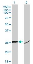 Anti-HMGB1 Mouse Monoclonal Antibody [clone: 1D5]