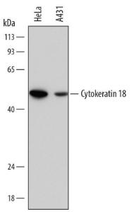 Anti-KRT18 Mouse Monoclonal Antibody [clone: 810811]