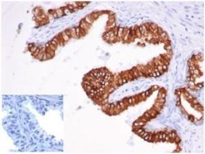 Anti-EpCAM Mouse Recombinant Antibody [Clone: rEGP40/826]