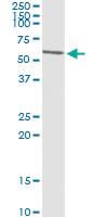 Anti-SMARCE1 Mouse Monoclonal Antibody [clone: 6G11]